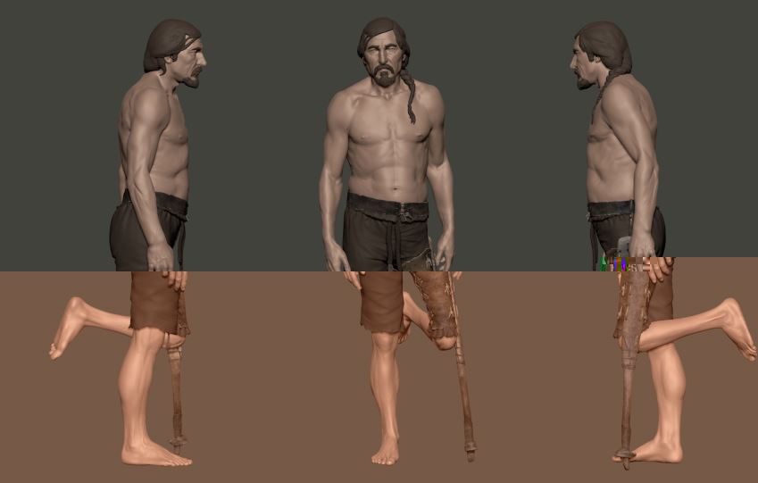 Chinese ankylosed knee 3 to 2 C BC reconstruction showing use of prosthesis found in tomb.JPG